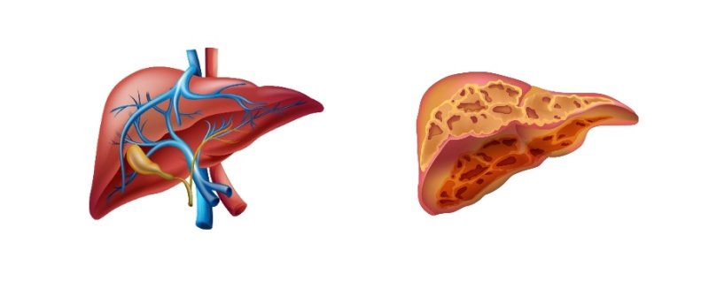 간 - 침묵의 장기 - Good Health