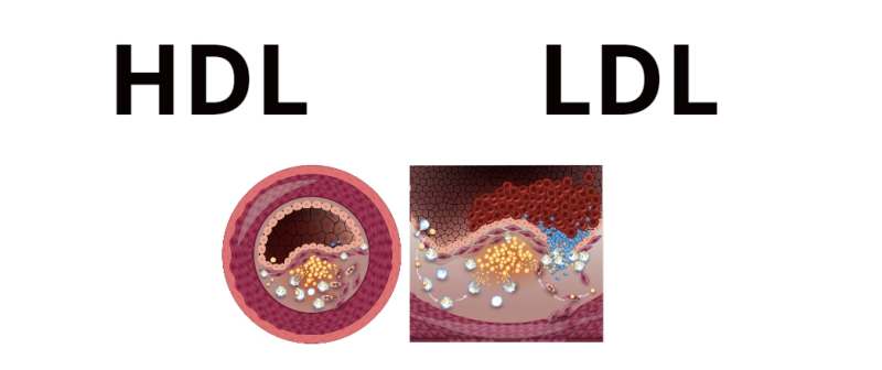 콜레스테롤 HDL 혈관 LDL
